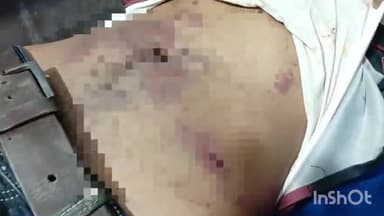 बहराइच: तालपालपुरवा में पैसे के विवाद में दबंगों ने एक युवक को जमकर पीटा, युवक हुआ घायल