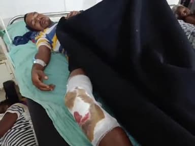 सिमडेगा: कोनबेगी के पास फोटो के धक्के से बाइक सवार व्यक्ति हुआ घायल