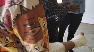 मंदसौर: 500 क्वार्टर टिगरिया में मामूली बात को लेकर दो लोगों ने महिला पर चाकू से किया हमला, पुलिस ने दर्ज किया मामला