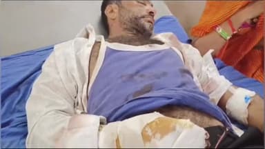 पीपलदा: इटावा के ककरावदा निवासी अधेड़ मोटरसाइकिल फिसलने से घायल, MBS में भर्ती