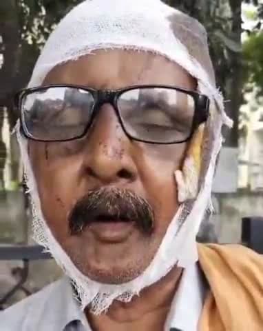 सरोजनी नगर: कृष्णा नगर क्षेत्र में दबंगों ने एक परिवार के साथ की मारपीट, दो पुरुषों और एक महिला हुई घायल