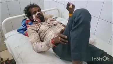 शिवपुरी नगर: भिलौड़ी गांव के पास मोड़ पर बाइक अनियंत्रित होकर स्लिप हुई, बाइक सवार गंभीर रूप से घायल