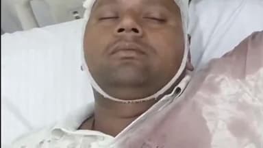 रायबरेली: अघौरा में चचेरे भाई को बचाने गए प्रधान और छोटे भाई पर दबंगों ने किया जानलेवा हमला, तीन लोग हुए घायल