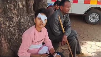 शिवपुरी नगर: गणेश कॉलोनी फतेहपुर में किन्नर बनने से मना करने पर राजस्थान के किन्नरों ने युवती पर पत्थर से किया हमला