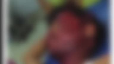 हज़ारीबाग: हरनगंज में दो अज्ञात लोगों ने विद्यार्थी को पीटकर लहूलुहान किया