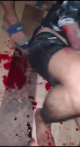 daga masin warkar ka hadasa