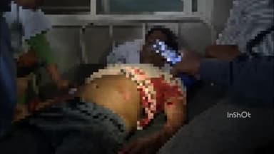 बाबई: माखननगर स्वास्थ्य केंद्र में मोबाइल टॉर्च की रोशनी में मरीजों का इलाज, BMO ने बताया शॉकिट खराब होने की बात