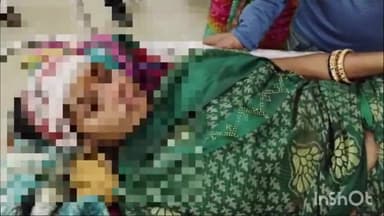 रायबरेली: बदई का पुरवा निवासी महिला सिर पर ईंट गिरने से हुई जख्मी, जिला अस्पताल में कराया गया भर्ती