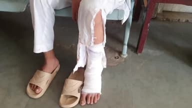 रामपुर: जमातुस्सालेहात स्कूल के पास तेज रफ्तार बाइक सवार युवक ने दूसरे बाइक सवार को मारी टक्कर, दोनों युवक घायल