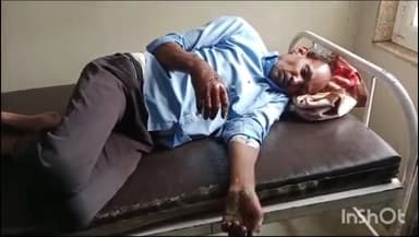 सरसवाही ग्राम में एक व्यक्ति पर आवारा कुत्ते ने किया हमला, अस्पताल में उपचार जारी