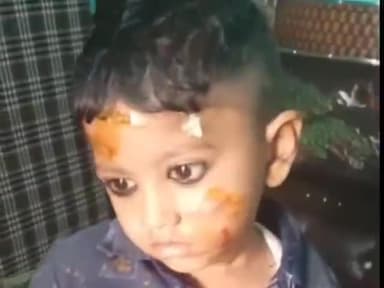 धनौरा: गजरौला के मोहल्ला मायापुरी में तेज रफ्तार बाइक की टक्कर से एक बच्चा हुआ घायल, अस्पताल में भर्ती