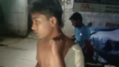 मेरठ: लिसाडी गेट के जामिया चौक पर डीसीएम हटाने की बात कहने पर किशोर पर धारदार हथियार से किया गया हमला, पुलिस से की गई शिकायत