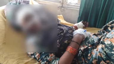 रामपुर: मढेया बाईपास के पास तेज रफ्तार मारुति चालक ने बाइक सवार दंपति को मारी टक्कर, दंपति घायल होकर जिला अस्पताल में भर्ती