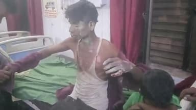 हाथरस: गांव रसगंवा में गंधक और पटास एक साथ पीसते समय हुआ धमाका, 1 किशोर और 1 मासूम घायल, जिला अस्पताल में कराया गया भर्ती