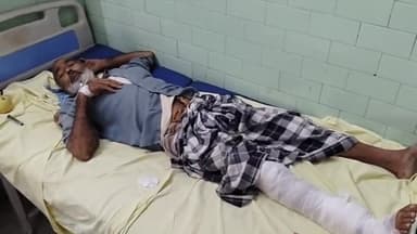 बरेली: थाना नवाबगंज क्षेत्र के ग्राम बरखन निवासी पिता-पुत्र पर धारदार हथियार से हमला, दोनों घायल