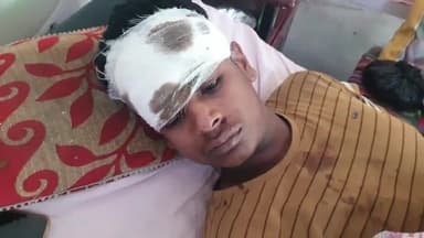 रामपुर: ग्राम अहमदाबाद में मोटरसाइकिल ने ई-रिक्शा को मारी टक्कर, हादसे में एक युवक घायल, ज़िला अस्पताल में भर्ती