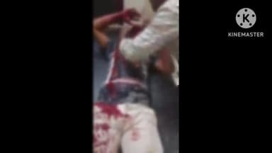 खुरई: दोस्तों के विवाद में स्टेशन के पास कटर चला, दो घायल, एक गंभीर, जिला अस्पताल रेफर, पुलिस जांच में जुटी