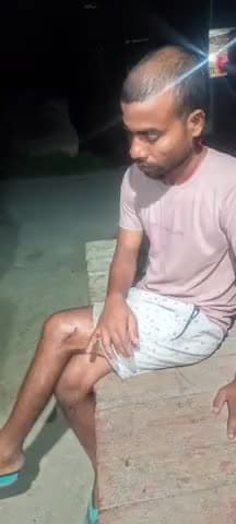 गोरौल: रुसुलपुर कोरीगाव में गीदड़ का आतंक, किसान हुआ जख्मी, निजी चिकित्सक से कराया इलाज