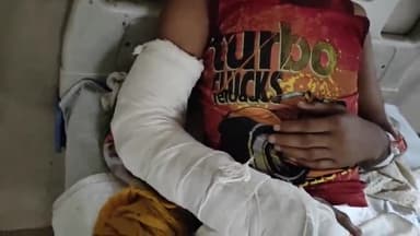 पीपलदा: स्टेट हाइवे 70 पर मुंगेना गांव के निकट बाइक सवार युवक भेस से टकराकर घायल, MBS अस्पताल में भर्ती