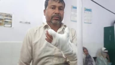 रामपुर: बिलासपुर के प्रवीण मुहल्ले में रावण बम जलाते समय युवक के हाथ में बम फटा, युवक जिला अस्पताल में भर्ती