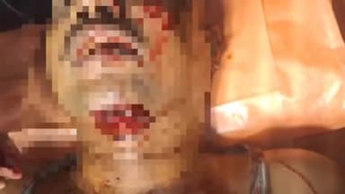 अमानगंज: पाठा नाला के पास तेज रफ्तार मोटरसाइकिल और स्कूली वैन की टक्कर, बाइक चालक घायल