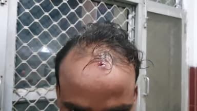 रामपुर: कोयली गांव में पत्नी के साथ भैया दूज मनाने आए युवक को ससुराल वालों ने पीटा, पीड़ित ने पुलिस से की शिकायत