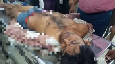 हरदोई: नयापुरवा गांव में ग्राम समाज की जमीन पर बांस लगाने से मना करने पर 4 लोगों ने युवक को लाठी-डंडों से पीटा