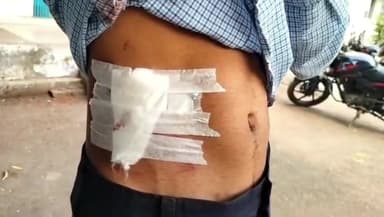 देवरी: देवरी में पुरानी रंजिश के चलते कॉलेज के छात्र पर कटर से हमला