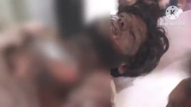 प्रतापगढ़: सुरंगपुर गांव में हार्वेस्टर से धान की कटाई के दौरान हाई टेंशन तार की चपेट में आने से युवक गंभीर रूप से घायल