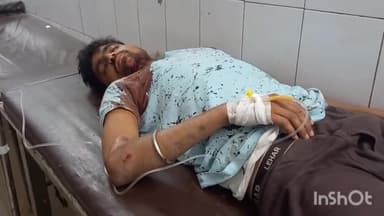 हरदोई: ऐजा फार्म के पास बाइक सवार 2 लोगों को प्राइवेट बस ने मारी टक्कर, दोनों को मेडिकल कॉलेज में भर्ती कराया गया