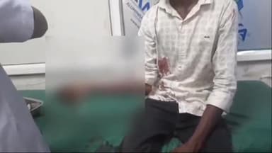 अररिया: प्रसादपुर गांव में आपसी विवाद में एक युवक पर ब्लेंड से वार कर किया जख्मी, सदर अस्पताल में भर्ती