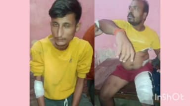 मिहींपुरवा: मिहींपुरवा के बिछिया सुजौली मार्ग पर चलती बाइक पर तेंदुए ने किया हमला, बाइक सवार सहित 2 घायल, इलाज जारी