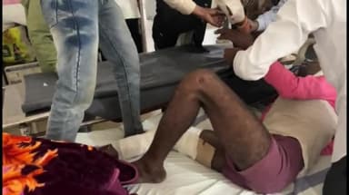 टीकमगढ़: अजनौर गांव में दो बाइकों की टक्कर में तीन लोग घायल, जिला अस्पताल में भर्ती