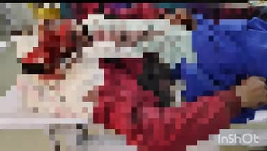 सलोन: सलोन-प्रतापगढ़ बॉर्डर पर तेज रफ्तार अज्ञात वाहन ने मोटरसाइकिल सवार को पीछे से मारी टक्कर, युवक की हालत गंभीर