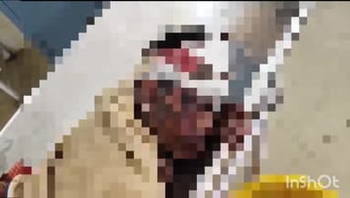 सलोन: रोखा गांव में तेज रफ्तार मोटरसाइकिल सवार ने साइकिल सवार को मारी टक्कर, तीन लोग गंभीर रूप से घायल