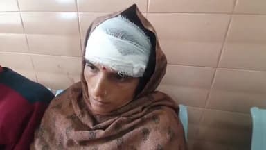 रामपुर: विचार खाता गांव में जमीनी विवाद के चलते सगे भाई ने अपने भाई की पत्नी को पीटकर किया घायल, रिपोर्ट दर्ज