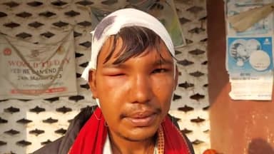 लौवा-चकिया गांव में बाराती में फरमाइशी गीत बचाने के विवाद को लेकर हुई मारपीट में 13 घायल