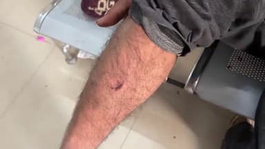 टीकमगढ़: तखा गांव में पति-पत्नी पर दो लोगों ने किया हमला, दोनों को जिला अस्पताल में भर्ती कराया गया