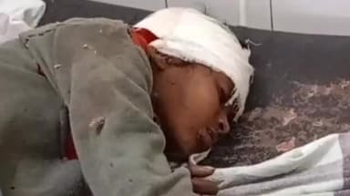 शिवपुरी नगर: डोड़याई रेलवे ट्रैक के पास झाड़ियों में घायल अवस्था में मिला नाबालिग, जिला अस्पताल में इलाज जारी