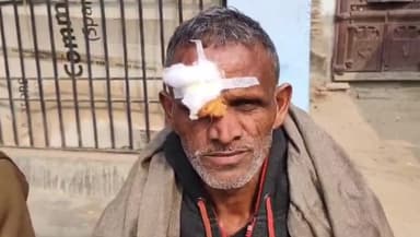 जहानाबाद: सिगोड़ी कनौरा गांव में आवारा पागल कुत्ते का आतंक, सात लोगों पर किया हमला