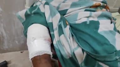 पीपलदा: इटावा थाना क्षेत्र के पीपल्दा गांव में मोटरसाइकिल फिसलने से एक युवक हुआ घायल, MBS अस्पताल में कराया गया भर्ती