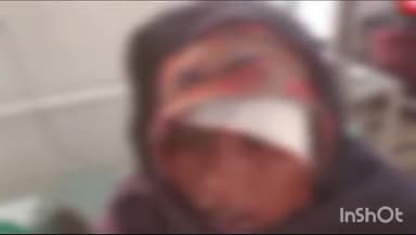 बोचहां: बोचहां थाना क्षेत्र में शौच के लिए निकली महिला के साथ दुर्व्यवहार, विरोध करने पर मारपीट कर घायल किया