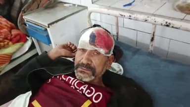 पन्ना: टिकुरिया मोहल्ले में जमीनी विवाद के चलते 50 वर्षीय व्यक्ति पर किया गया पत्थरों से हमला, जिला अस्पताल में इलाज जारी