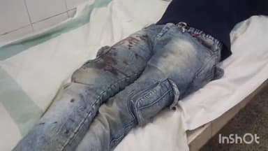 लखीसराय: रामचंद्रपुर गांव में जमीनी विवाद को लेकर हुई मारपीट में पिता-पुत्र घायल, उपचार जारी