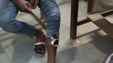 हथुआ: बसडीला गांव में तालाब किनारे पिकनिक मना रहे युवक को बदमाशों ने मारी गोली, एक बदमाश को ग्रामीणों ने पकड़ा