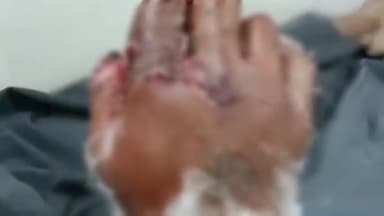 रामगंजमण्डी: सातलखेड़ी तोल कांटे पर कोटा स्टोन से भरे ट्रक से पत्थर गिरने से एक मजदूर की उंगलियां कटी, मजदूरों ने किया हंगामा