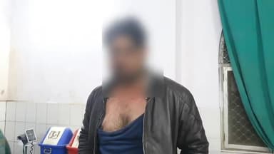 रामपुर: घेर मर्दान खान मोहल्ला में बाइक की टक्कर से नाराज 3 युवकों ने 1 युवक की पिटाई की, युवक ने थाने में दर्ज कराई शिकायत