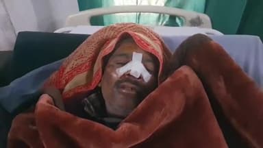 रामपुर: शनिवार को किले के निकट पान दरीबे पर ई-रिक्शा की टक्कर से मोटरसाइकिल सवार बाप-बेटी घायल हुए