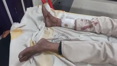 कहरा: ठाकुरपट्टी टोला में कर्ज के पैसे मांगने पर व्यक्ति के साथ हुई मारपीट, सदर अस्पताल में भर्ती