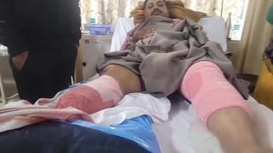 कैथल: NH152 D पर कस्बा ढांड के निकट कैंटर चालक ने ढांड थाना में तैनात SPO को टक्कर मारी, एक टांग कटी, गंभीर रूप से घायल